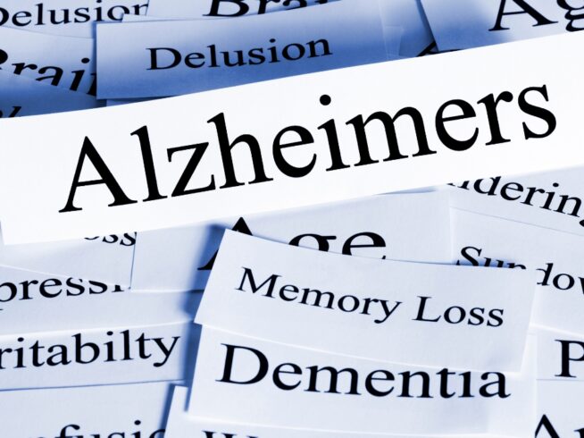 Alzheimers Disease; Dementia